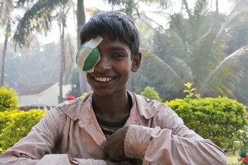 Ein Junge mit einer Augenklappe über seinem rechten Auge lächelt in die Kamera.