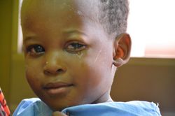 Ein Kind aus einem Entwicklungsland ist an Grünem Star erkrankt.