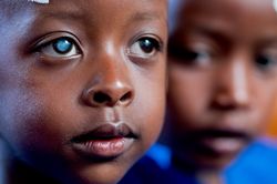 Ein Kind aus einem Entwicklungsland mit Grauem Star. Die getrübte Linse ist deutlich erkennbar.